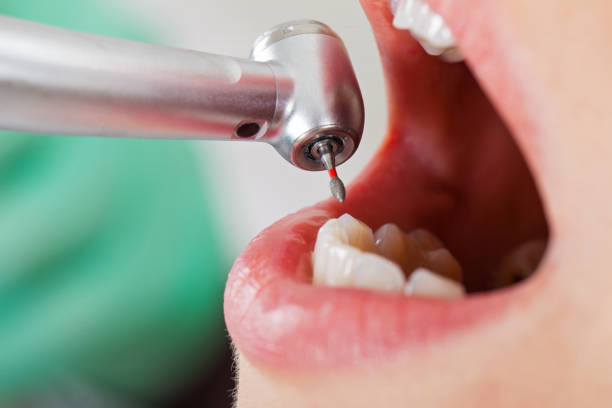Best Affordable Emergency Dental Care  in Granite Quarry, NC